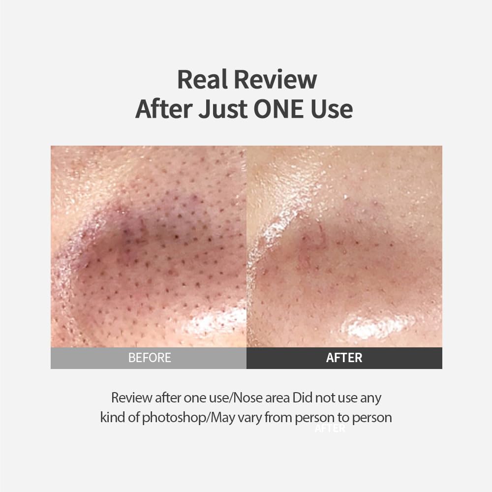 Sungboon Editor Blackhead Melting Clear Pad, 30 pads