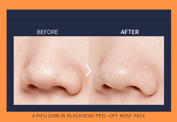 Apieu Goblin Blackhead 3-step Nose Pack - persiincorea