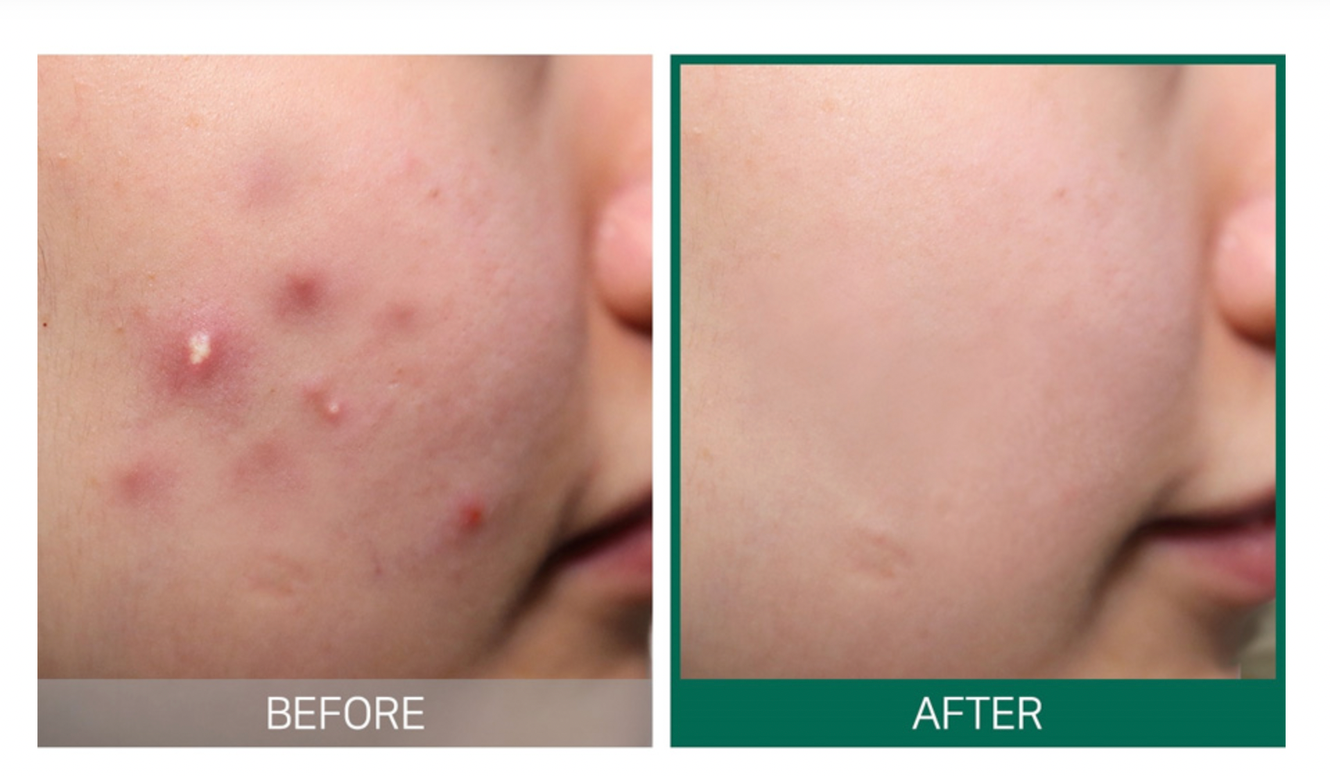 SOMEBYMI AHA-BHA-PHA 30 Days Miracle Cream, 60ml