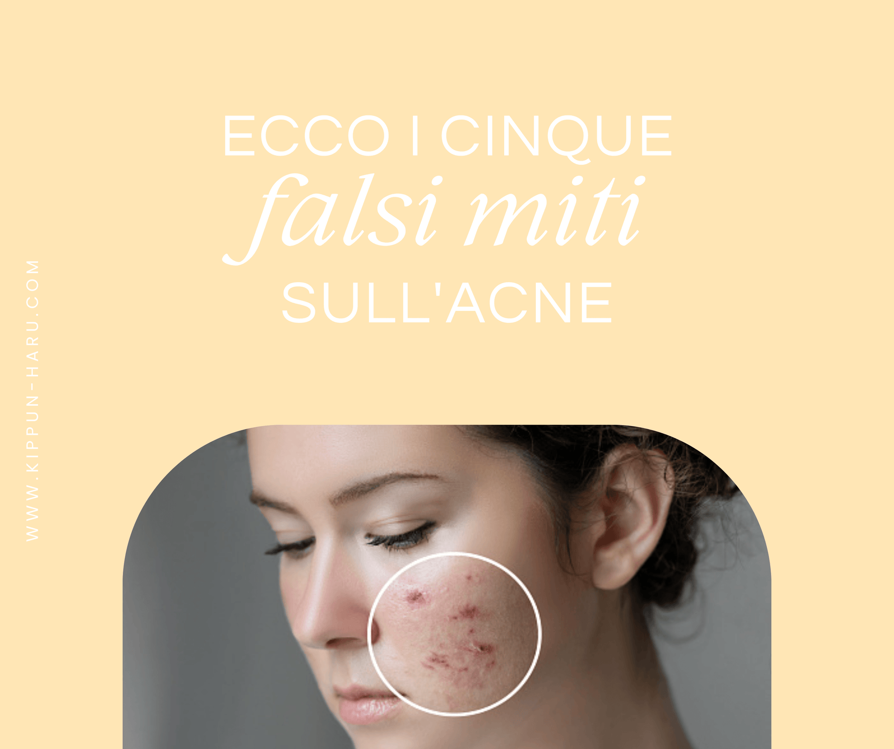 Ecco i 5 falsi miti sull'acne