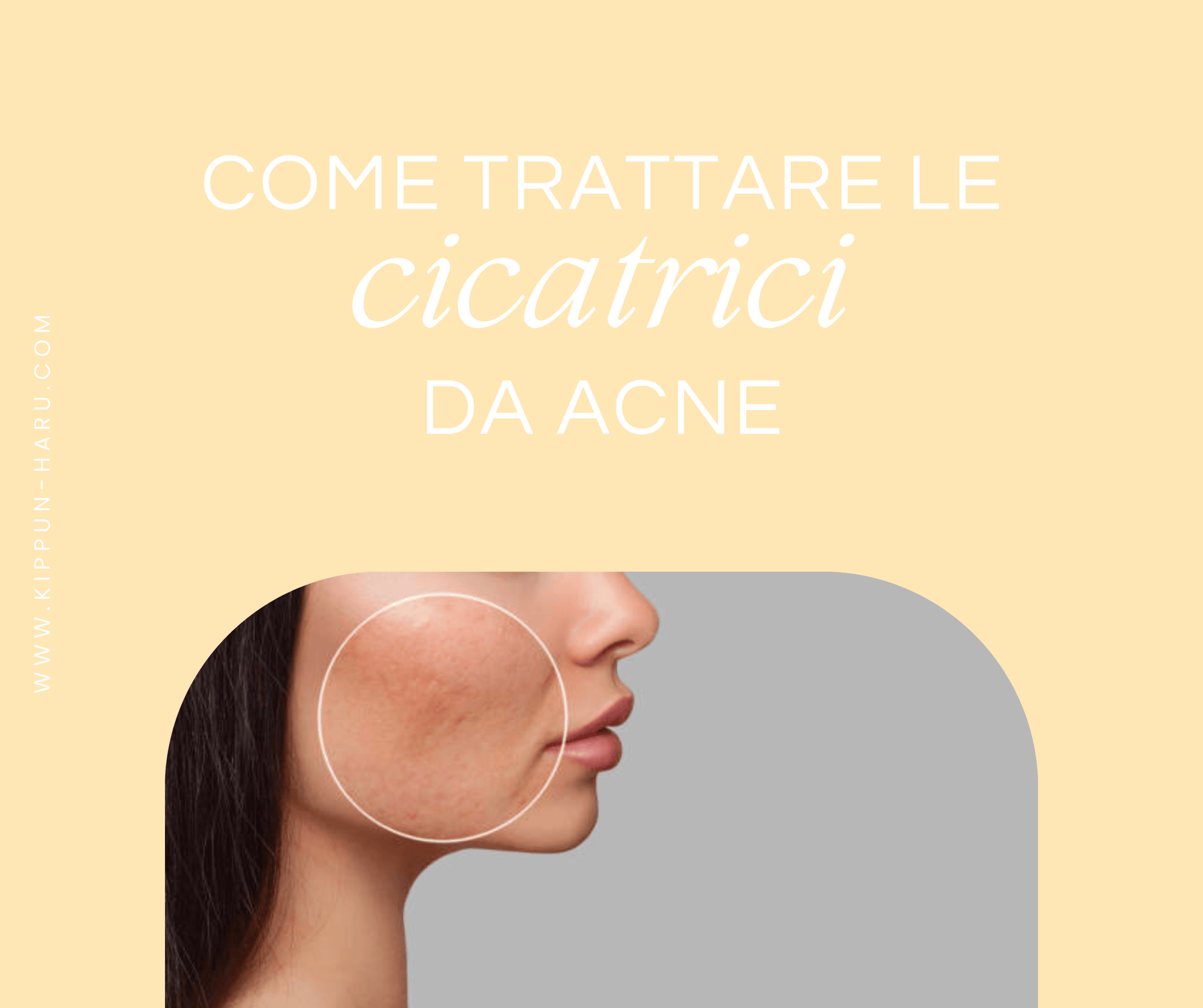 I migliori ingredienti di skincare coreana per le cicatrici da acne