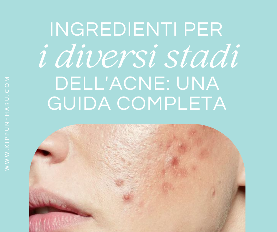 Ingredienti per i Diversi Stadi dell'Acne: Una Guida Completa