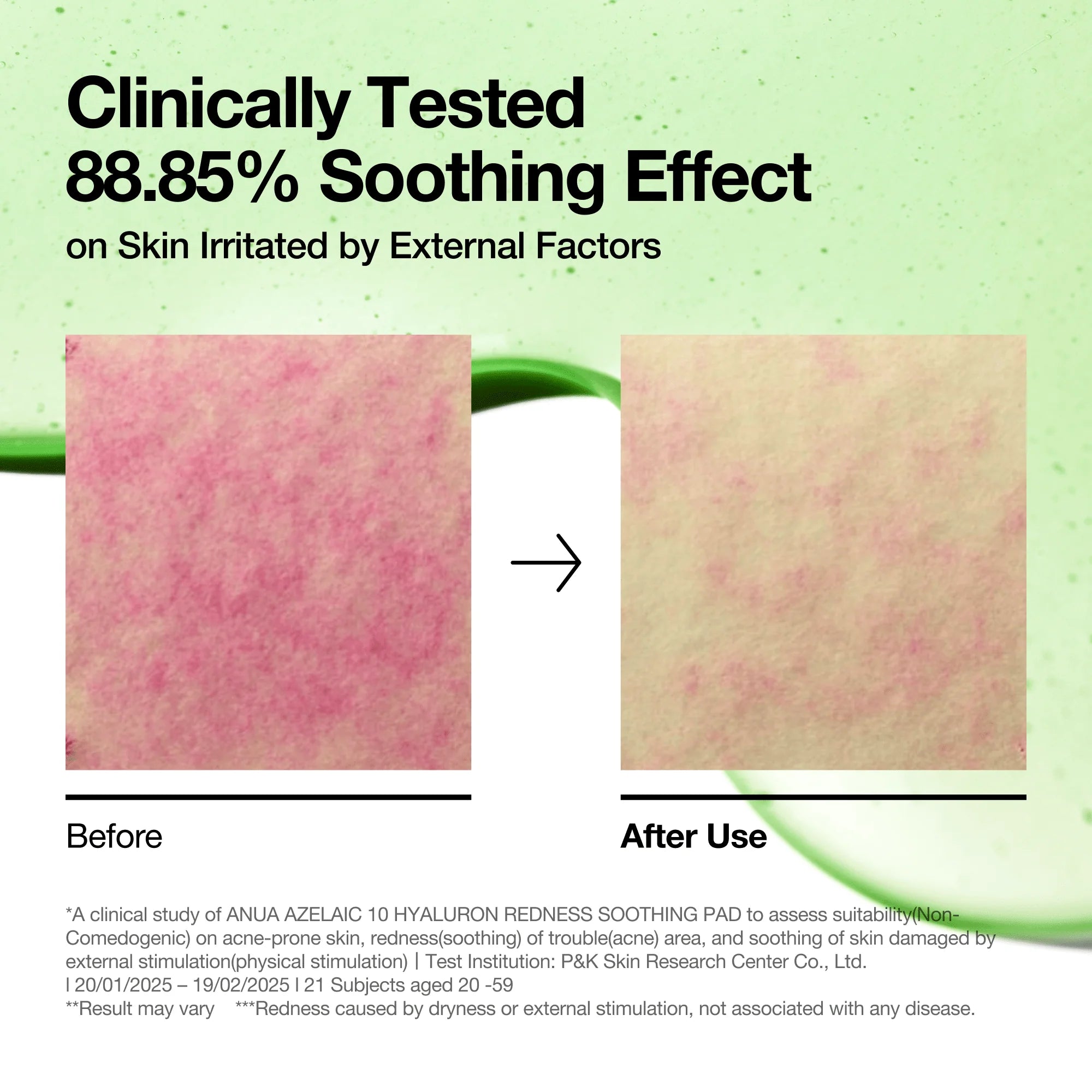 Anua Azelaic 10 Hyaluron Redness Soothing Pad, 90 dischetti