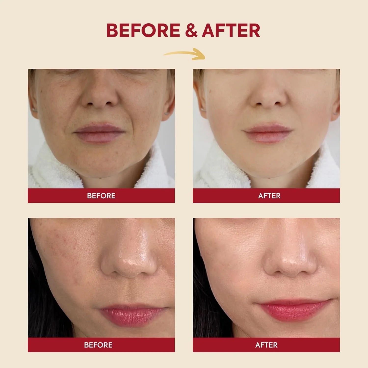 [OFFLINE] KSECRET SEOUL 1988 Essence: Snail Mucin 97% + Rice, 100ml