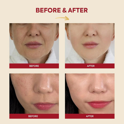 [OFFLINE] KSECRET SEOUL 1988 Essence: Snail Mucin 97% + Rice, 100ml