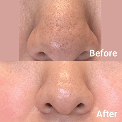 Medicube Zero Pore Pad 2.0, 155g, 70 dischetti