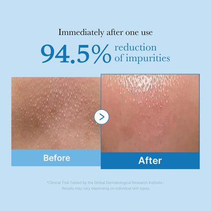 MEDICUBE Zero Pore Blackhead Deep Cleansing Oil, 205ml