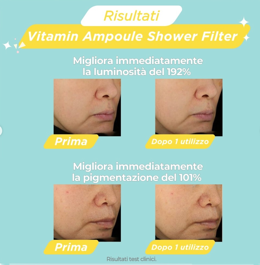 NOT4U Vitamin Ampoule Shower Filter