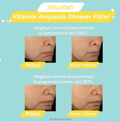 NOT4U Vitamin Ampoule Shower Filter