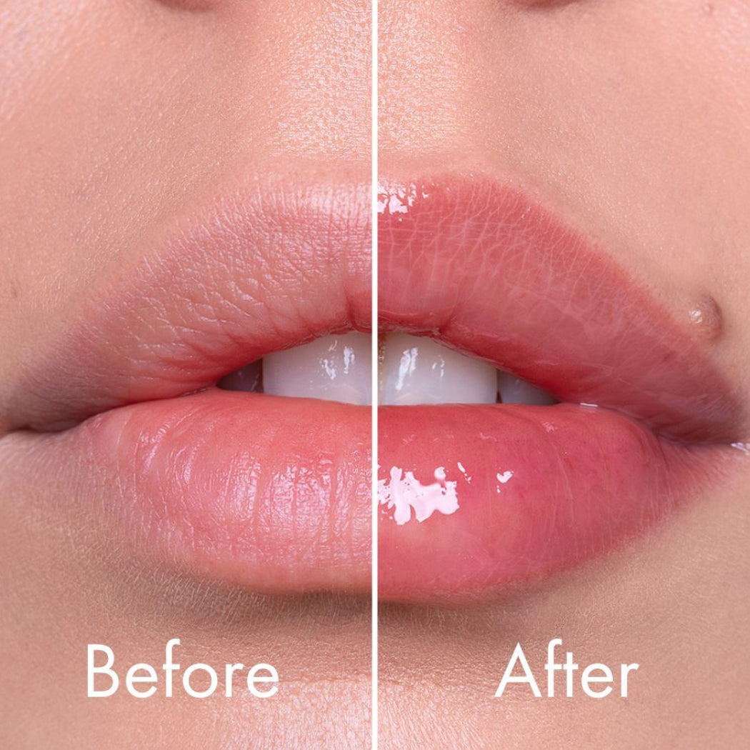 VT COSMETICS Reedle Shot Lip Plumper Expert, 4.3g