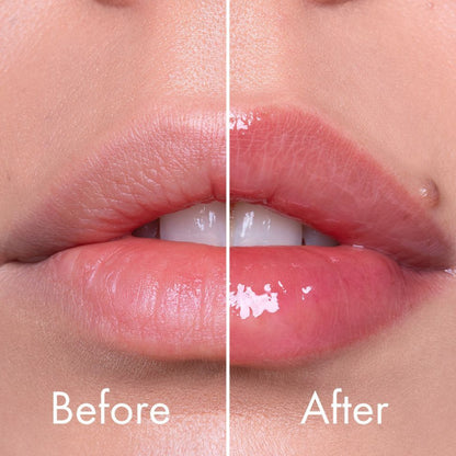 VT COSMETICS Reedle Shot Lip Plumper Expert, 4.3g