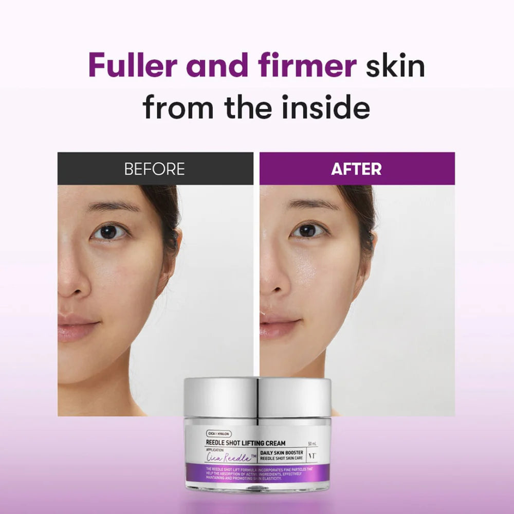 VT Reedle Shot Lifting Cream, 50ml