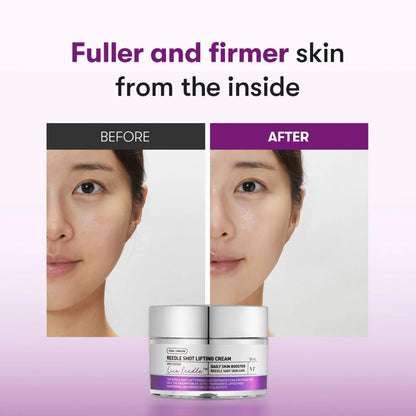 VT Reedle Shot Lifting Cream, 50ml