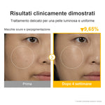 Risultati prima e dopo quattro settimane con Numbuzin No.5+ Glutathione Vitamin Concentrated Serum